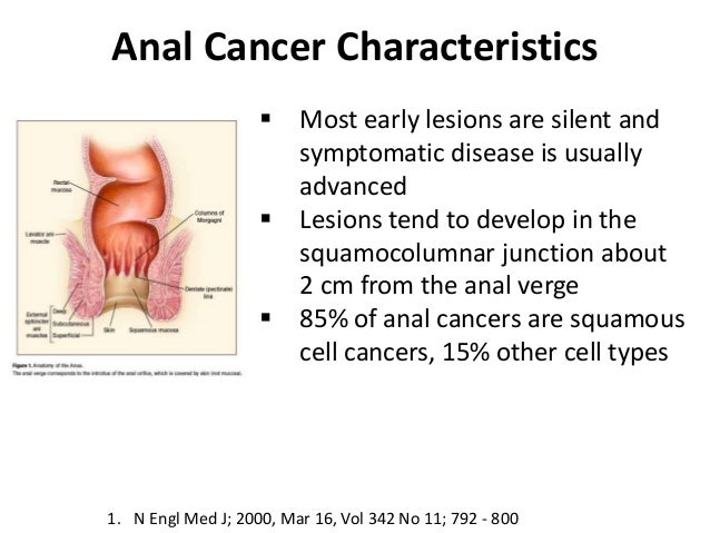 causes anal cancer Causes anal cancer